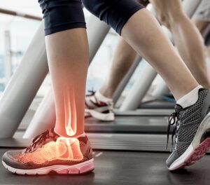 Why Does My Foot Hurt When I Walk? A Physical Therapist Explains What’s Going On