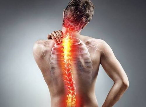 Back Pain