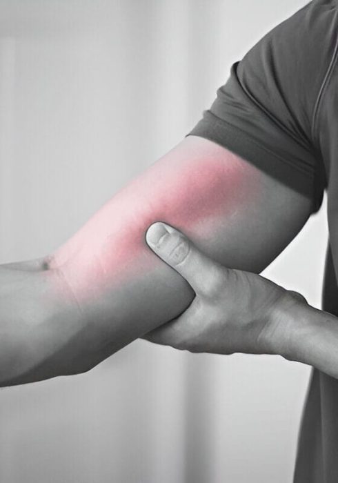 Bicep Tendonitis